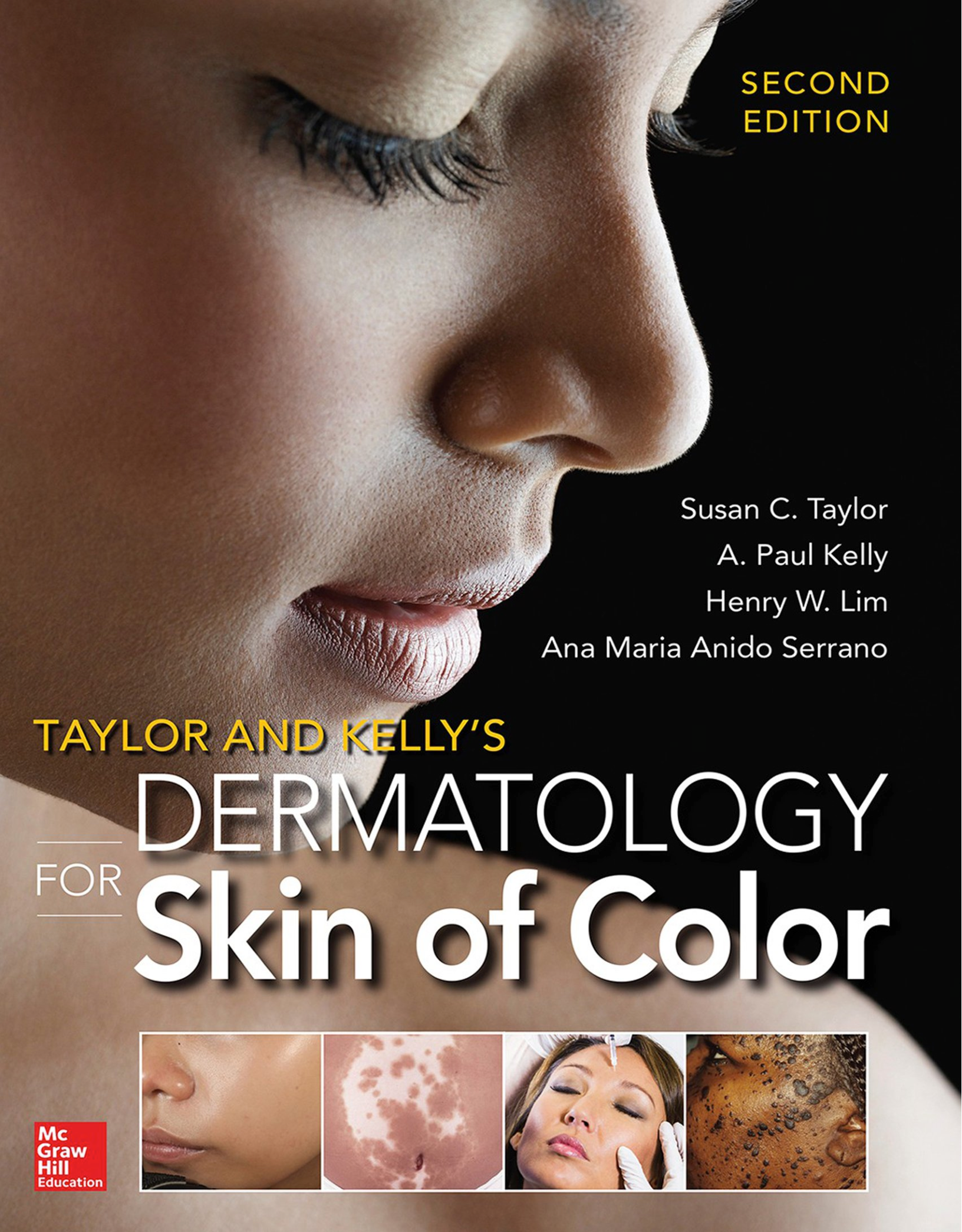 Taylor and Kelly’s Dermatology for Skin of Color by Susan Taylor, A
