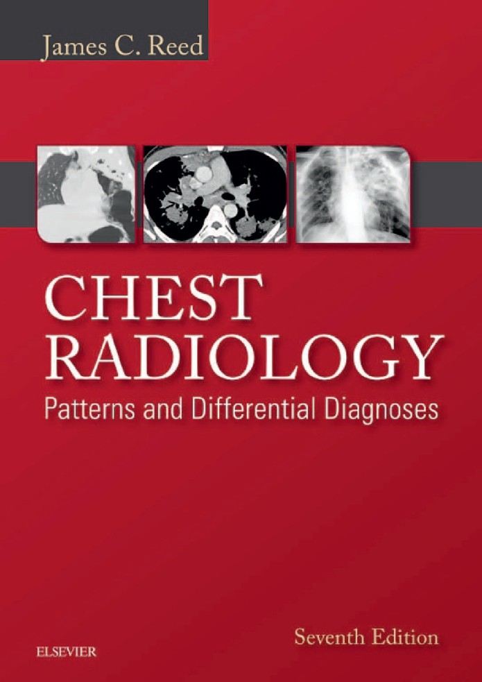 Chest Radiology Patterns and Differential Diagnoses, 7e (Reed, James Croft MD)