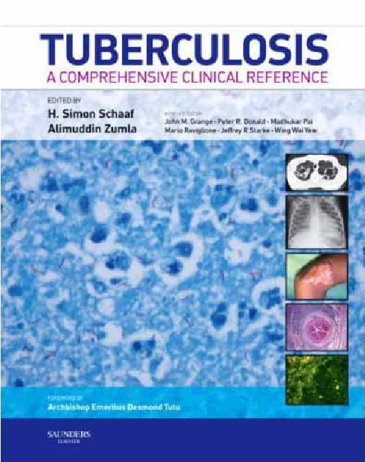 Tuberculosis A Comprehensive Clinical Reference