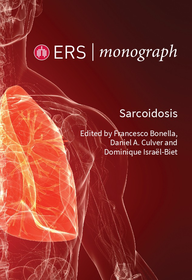 Sarcoidosis ERS Monograph ERS Monograph