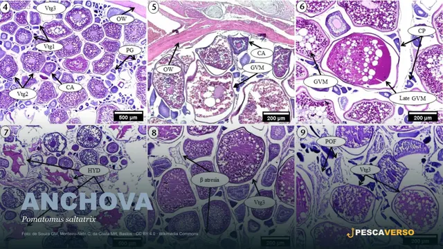 Anchova