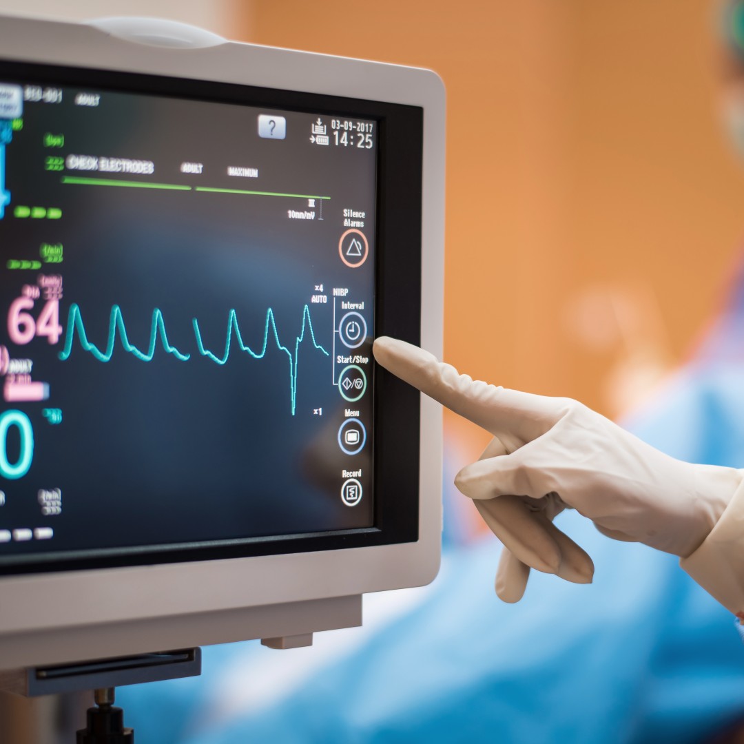 Can an EKG Test Be Used to Monitor Heart Health Over Time?