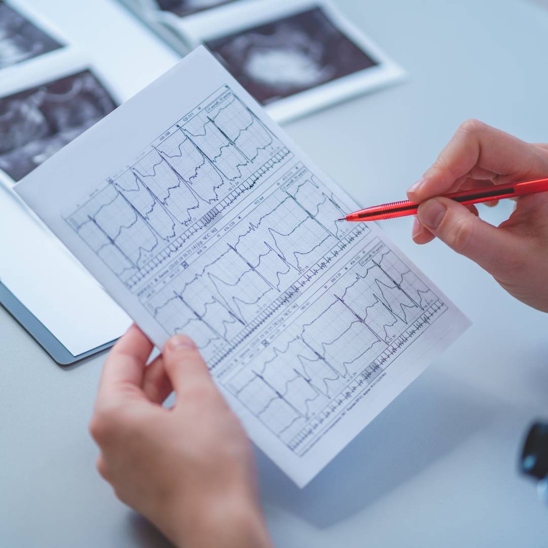 Can an EKG Be Used to Monitor Heart Medications?