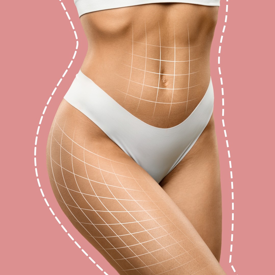 Is the Artemis T-Shape 2 the Right Treatment for Your Body Goals?