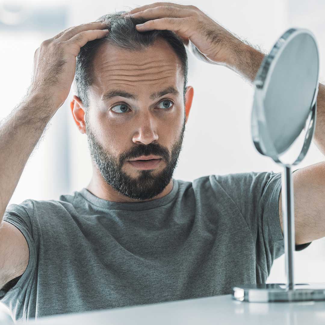 What Are the Latest Advances in Alopecia Treatments?