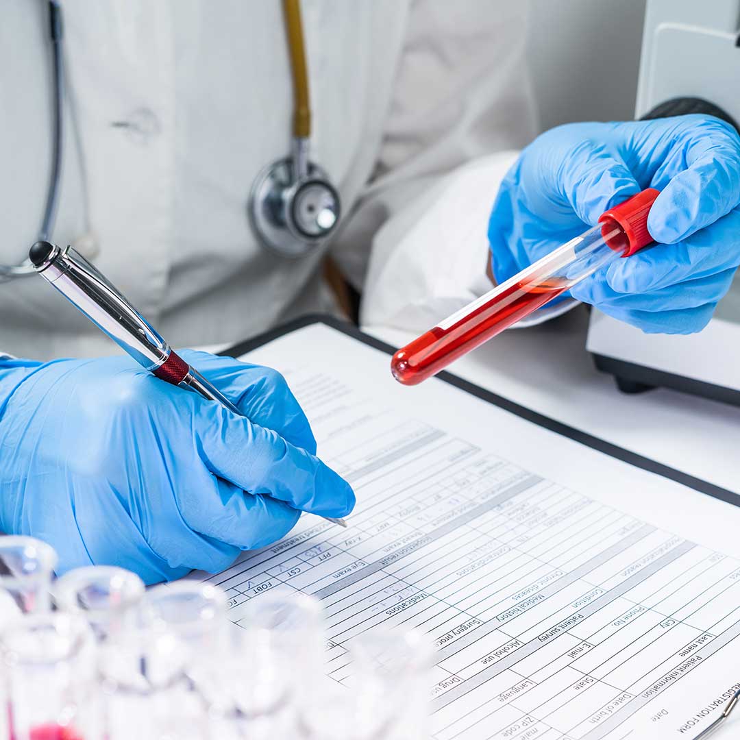 What Types of Drugs Are Typically Tested for in Drug Testing?