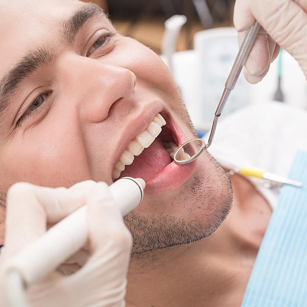 What Are Tooth Extractions?