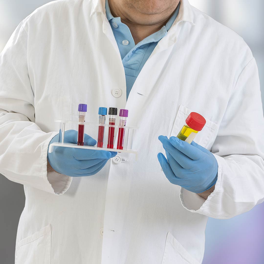 What Types of Tests Are Offered through Lab Services?