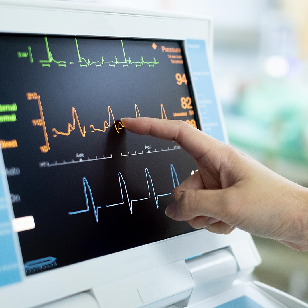 How Is an Electrocardiogram Performed?