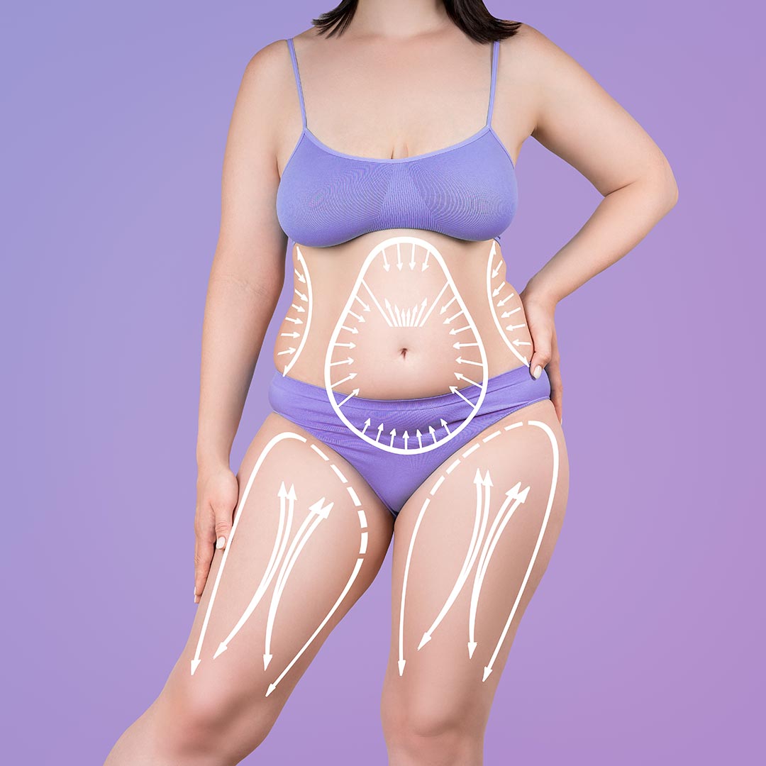 How Do I Know If I'm a Good Candidate for a Mommy Makeover?