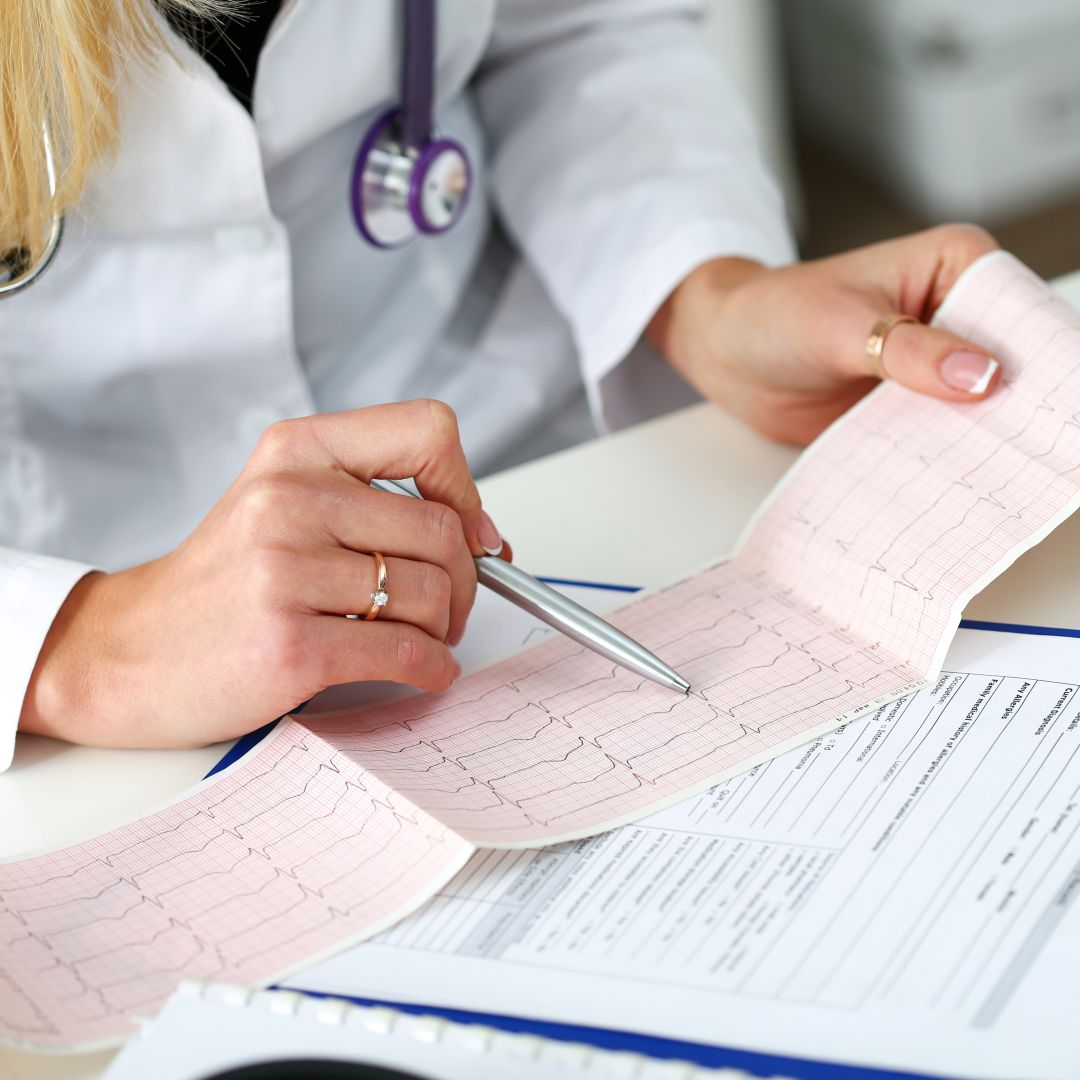 How Long Does an EKG Test Usually Take?