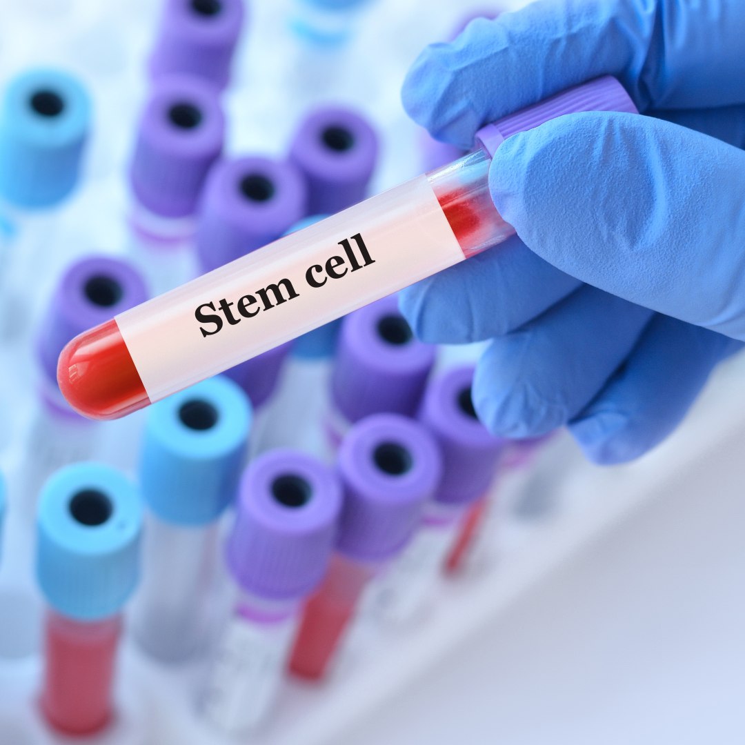 How Long Do the Results of Stem Cell Therapy Last?
