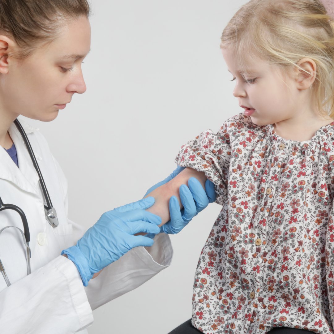 Is Skin Allergy Testing Safe for All Ages and Skin Types?