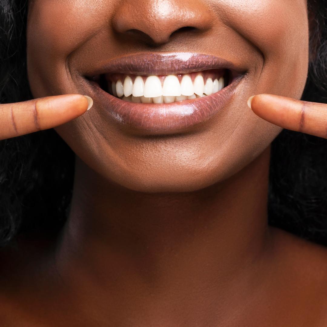 Can a Broken Tooth Be a Dental Emergency?