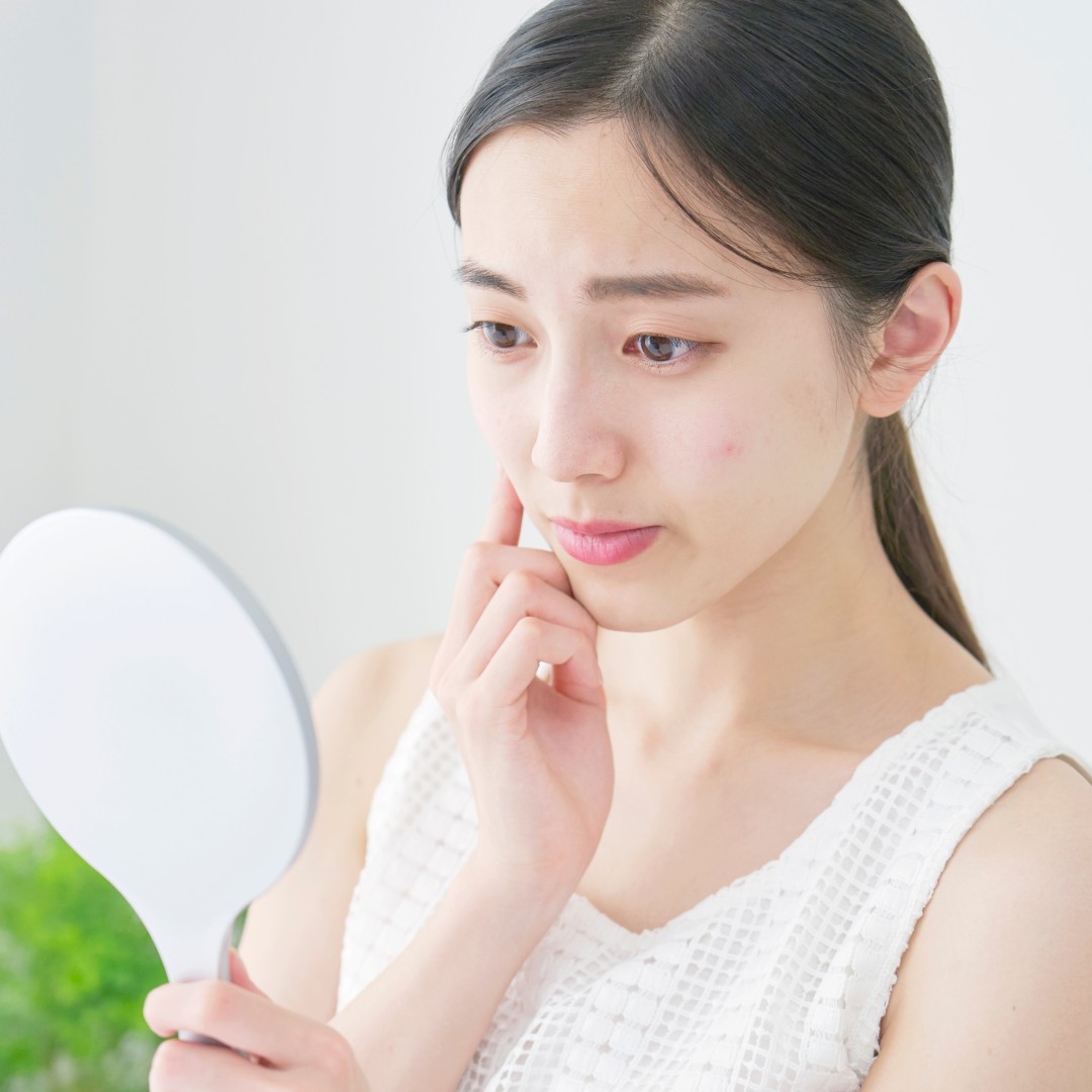 How Long Does It Take for Stress and Skin Problems to Show Improvement?