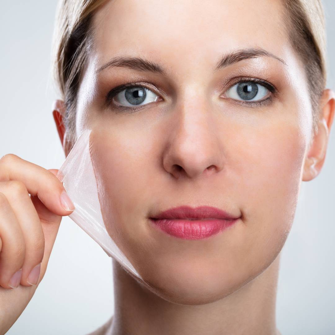 What Are the Different Types of Chemical Peels Available?