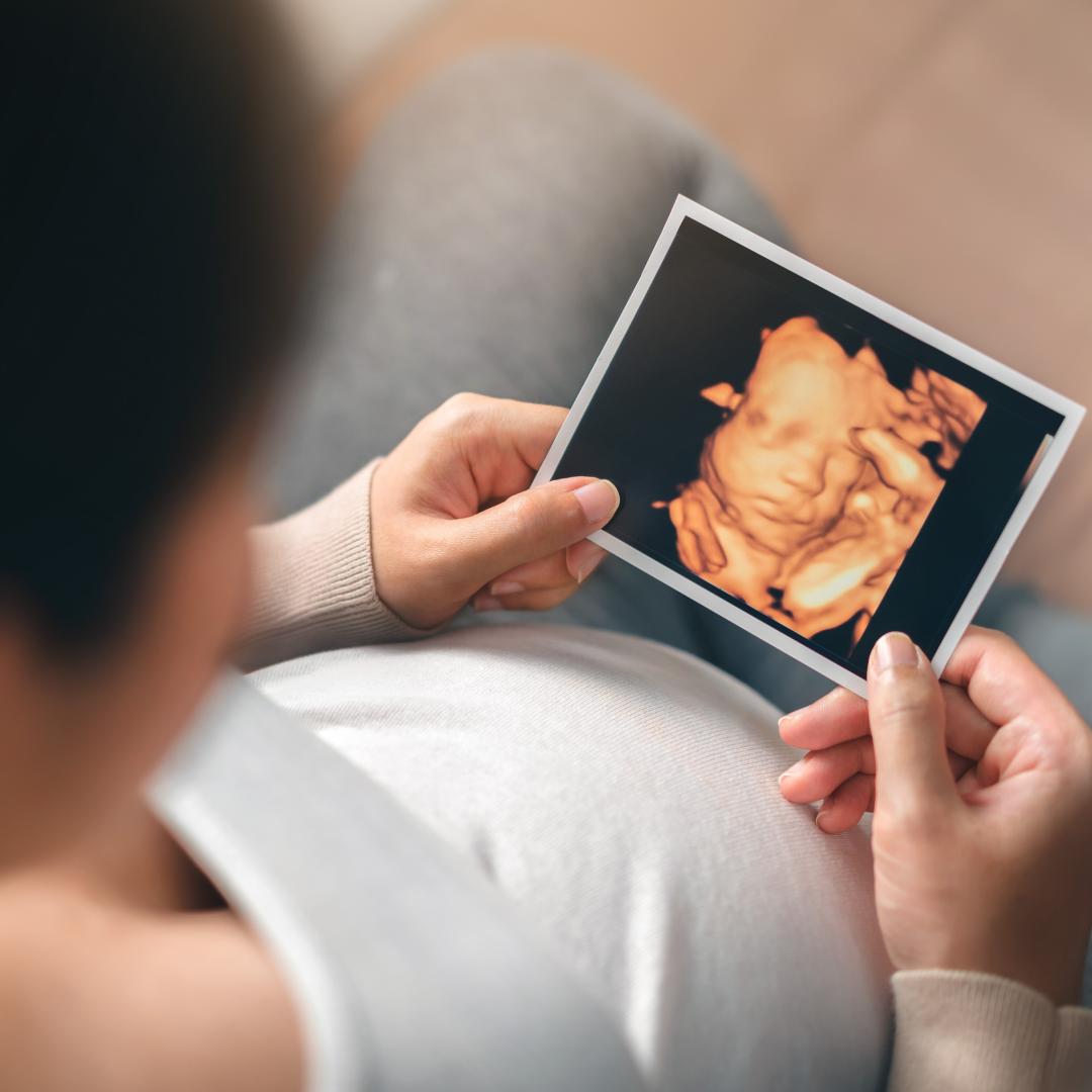 What Are 3D and 4D Ultrasounds During Pregnancy?