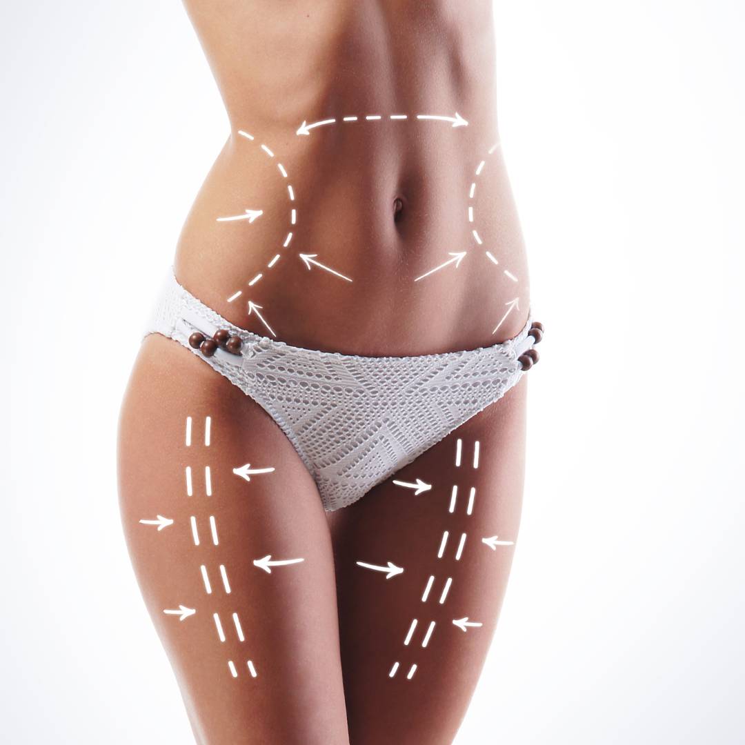 Spring Liposuction Special at Kureshi MedSpa: $2000 Per Body Part for a Slimmer You