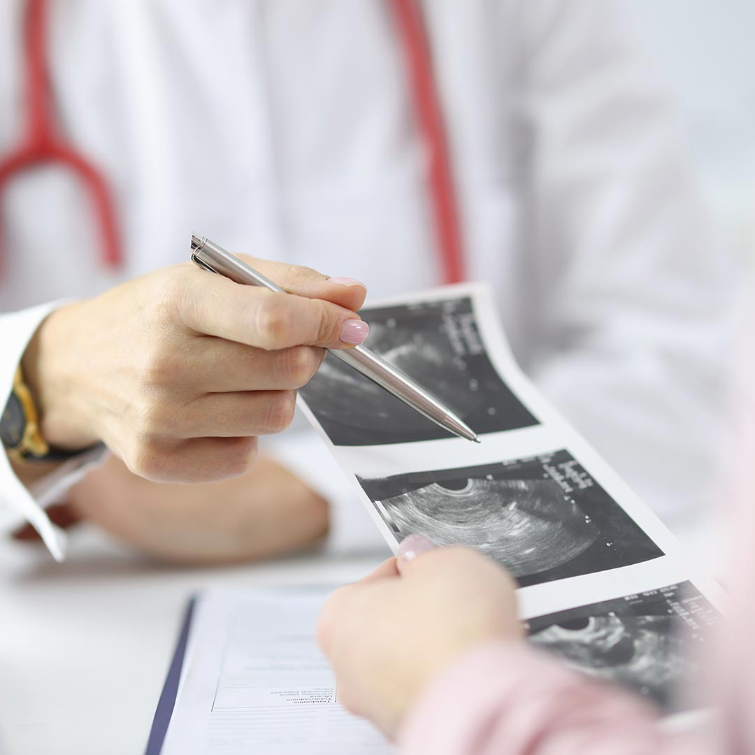 Can Ultrasound Scans Detect Gender?