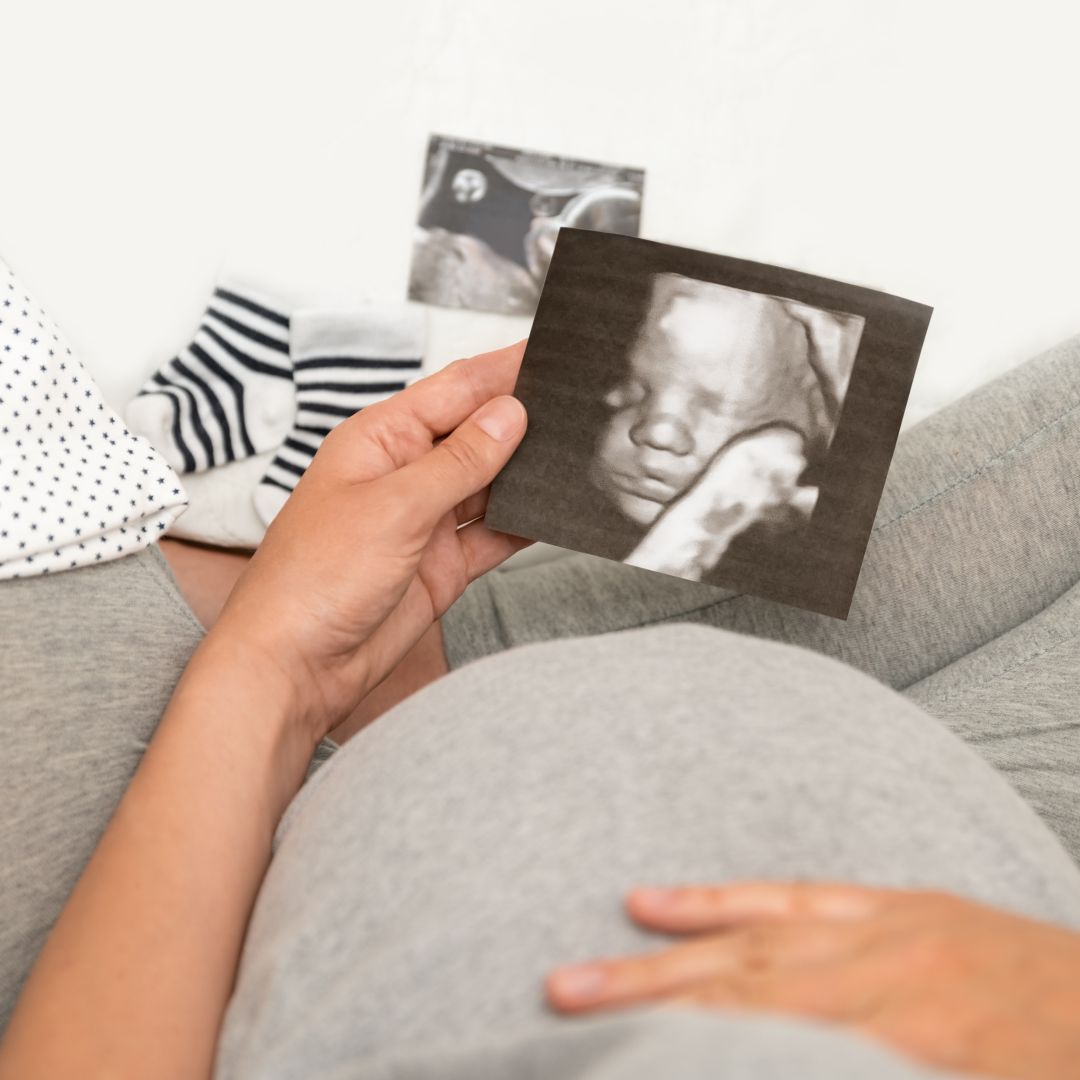 What Can I Expect during a 3D Ultrasound Imaging Session?