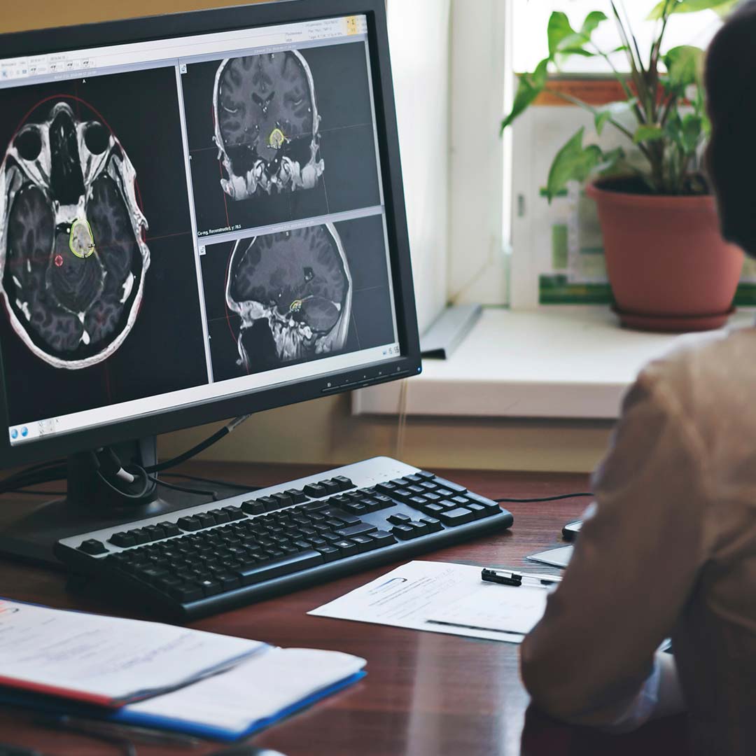 Recent trends in story