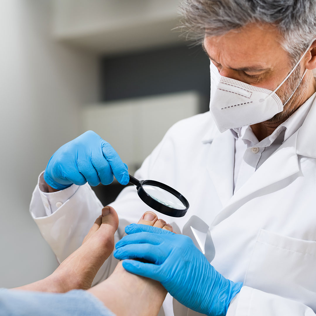 How Can Ingrown Toenails Be Prevented?