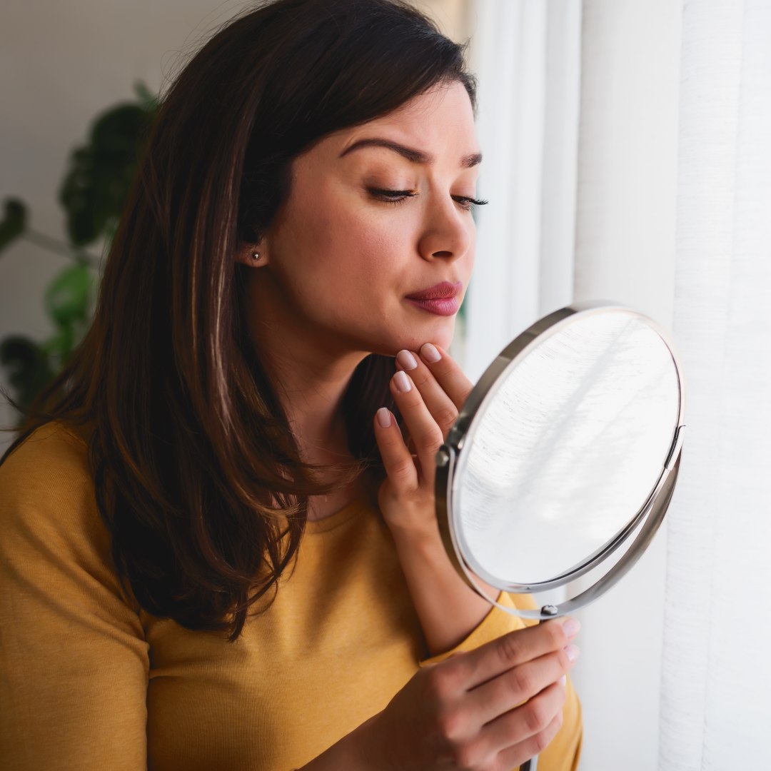 How Does Acne & Acne Scars Affect Your Self-Confidence?