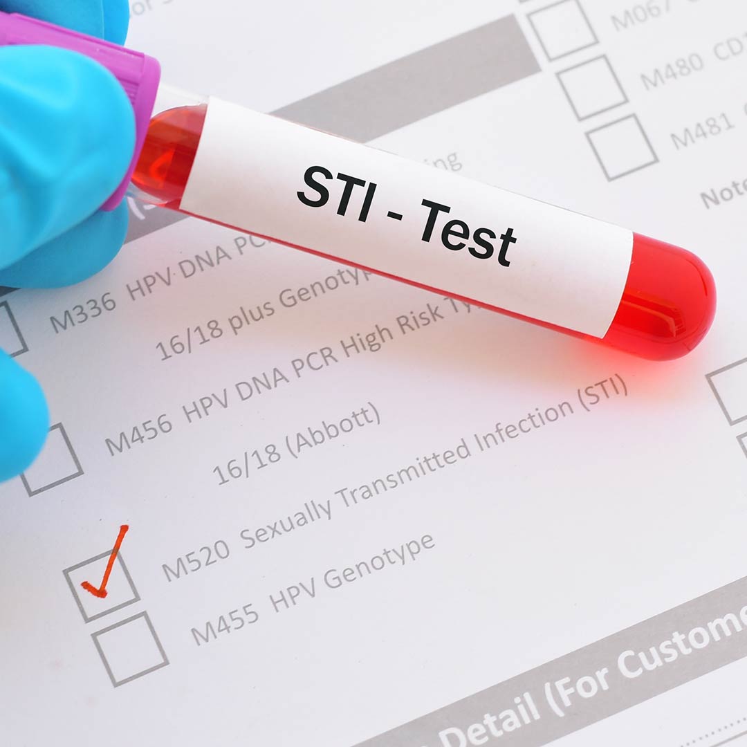 Why Is STI Testing Important?