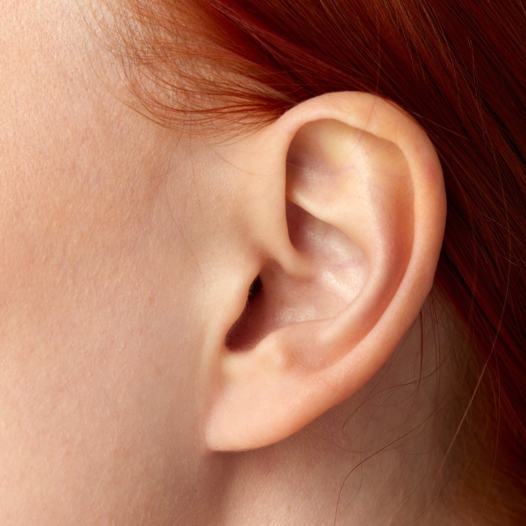 What Are the Main Benefits of Ear Pinning?