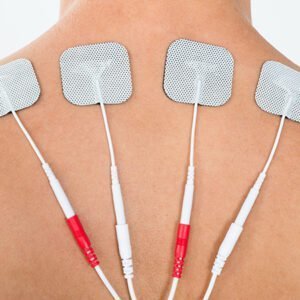 Physiotrex Self Adhesive Electrode Pads (White)