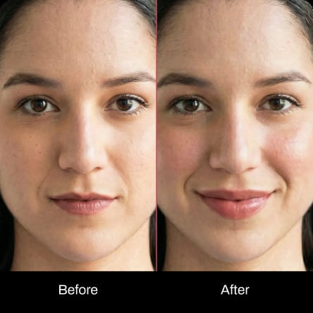 Corner Lift Correction