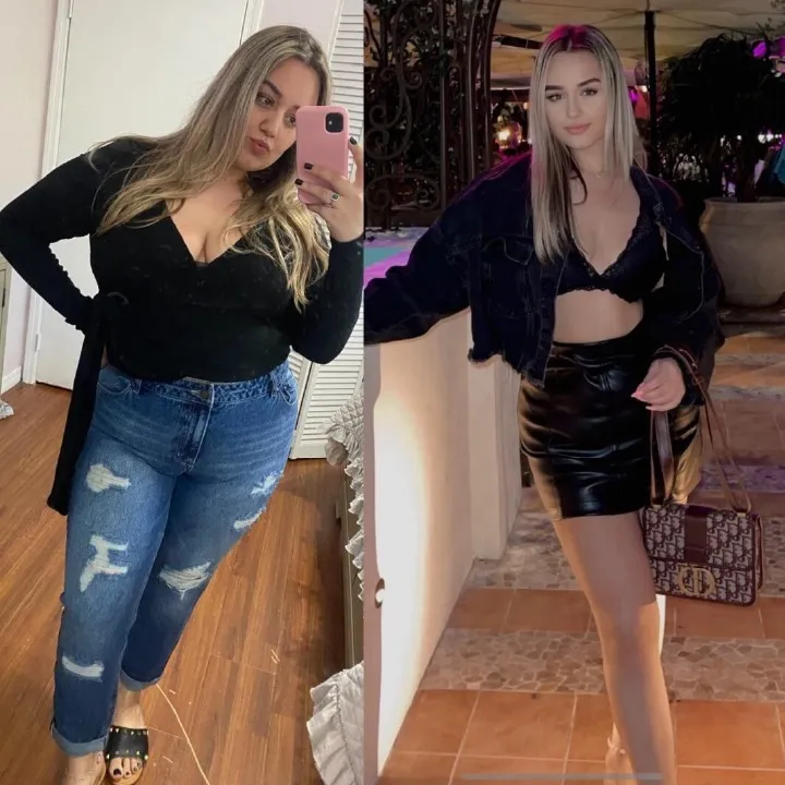 Before and after bariatric surgery: a woman in a black top and jeans before and in a denim jacket and skirt after her weight loss