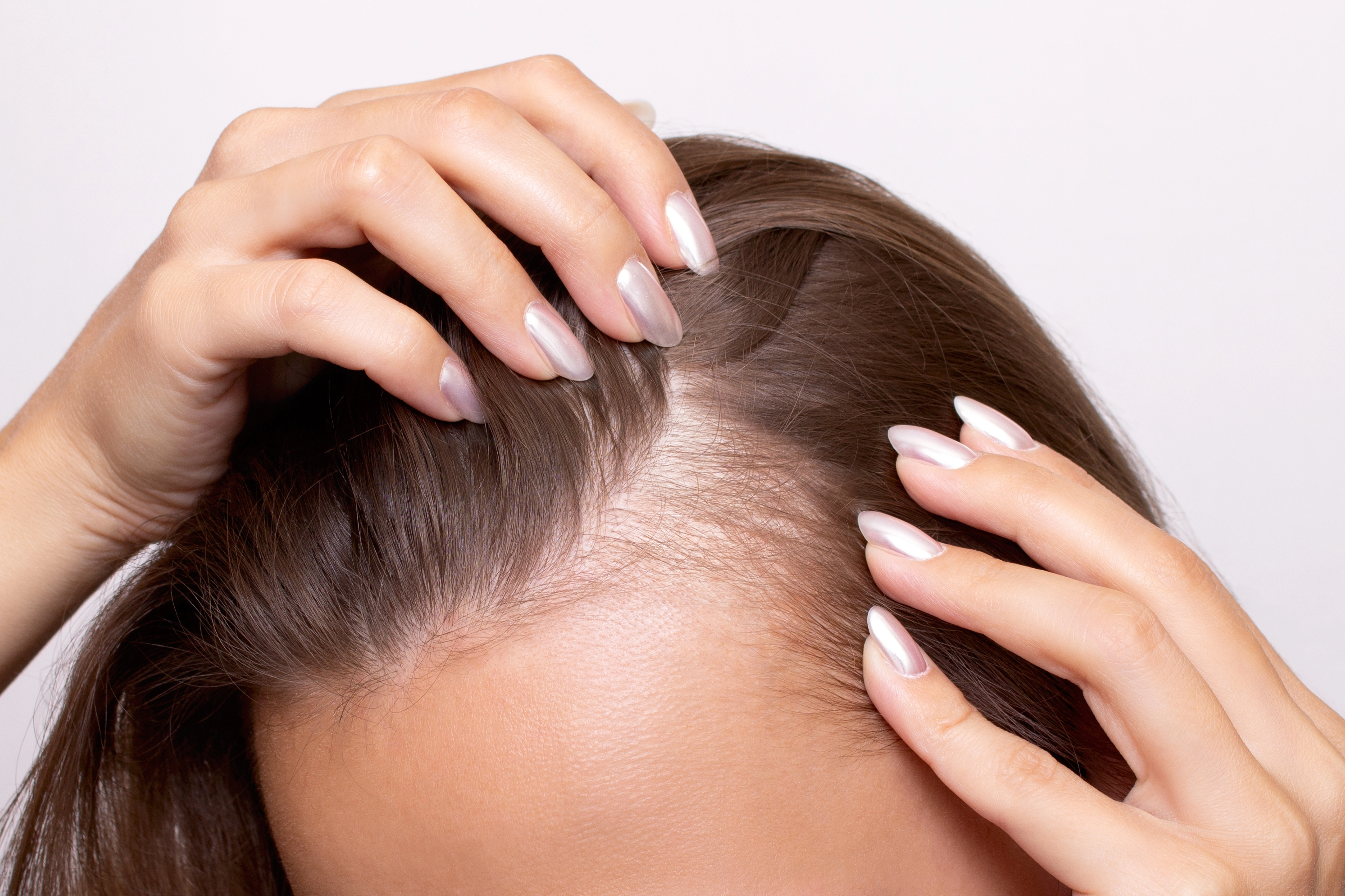 Woman parting her hair with both hands to show thinning along the part line