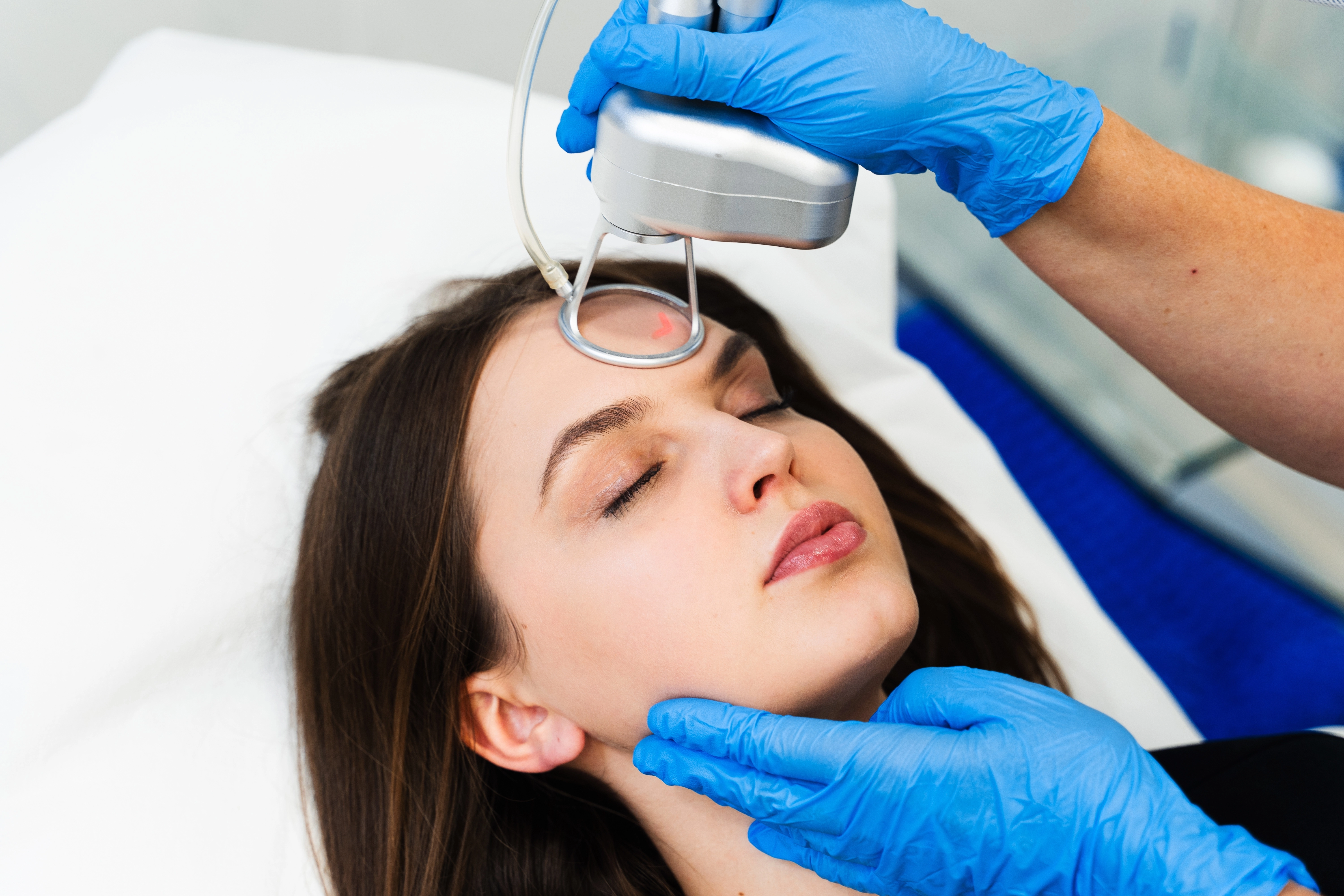 Handheld laser passing over a woman's forehead during a skin resurfacing treatment