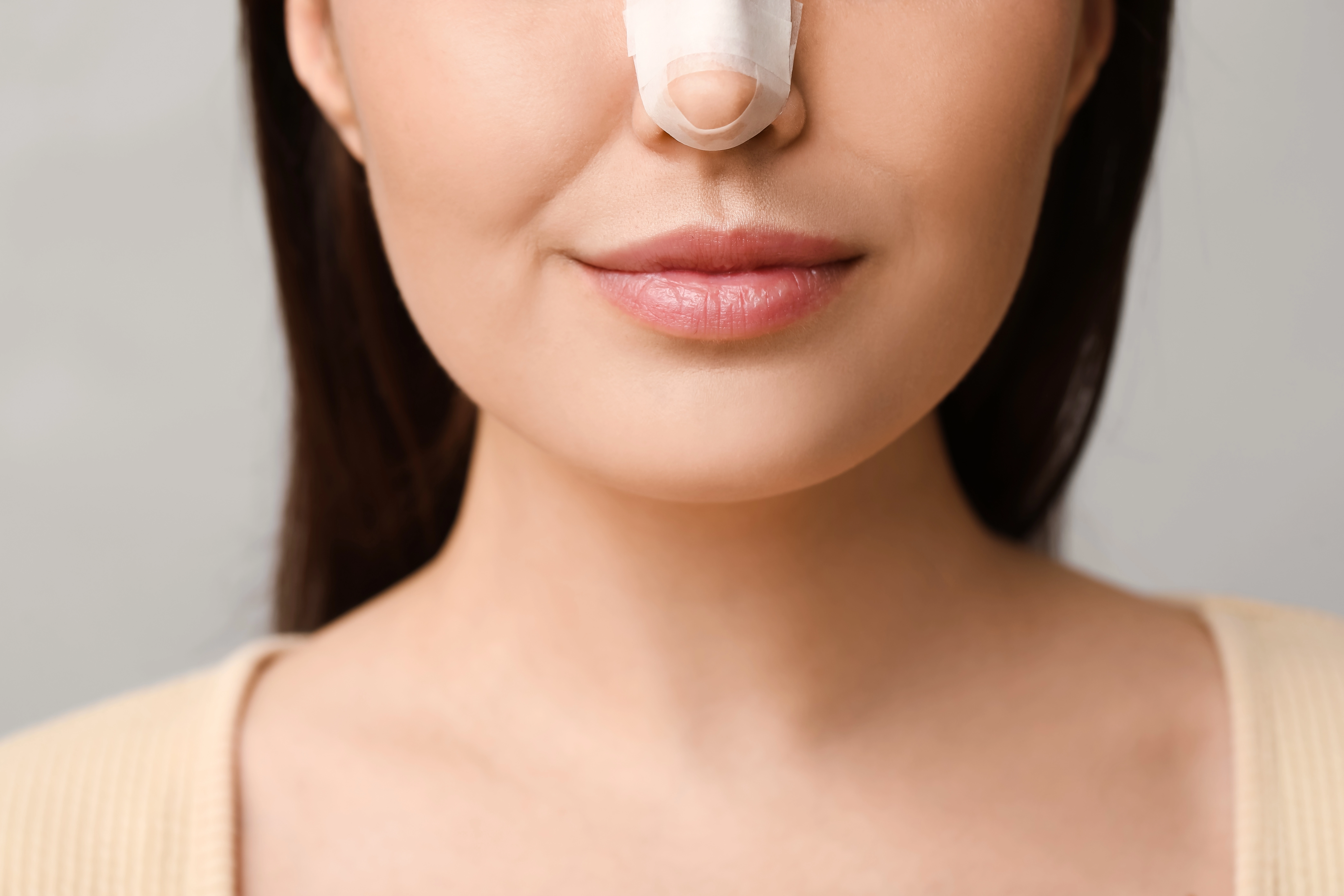 Close-up of a woman's lower face with a nasal splint bandage after rhinoplasty surgery