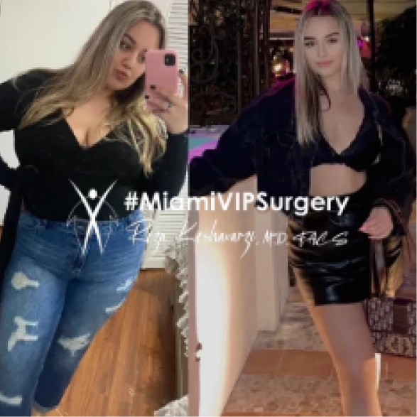 Before and after gastric sleeve surgery: a woman in jeans, then much slimmer in a black outfit