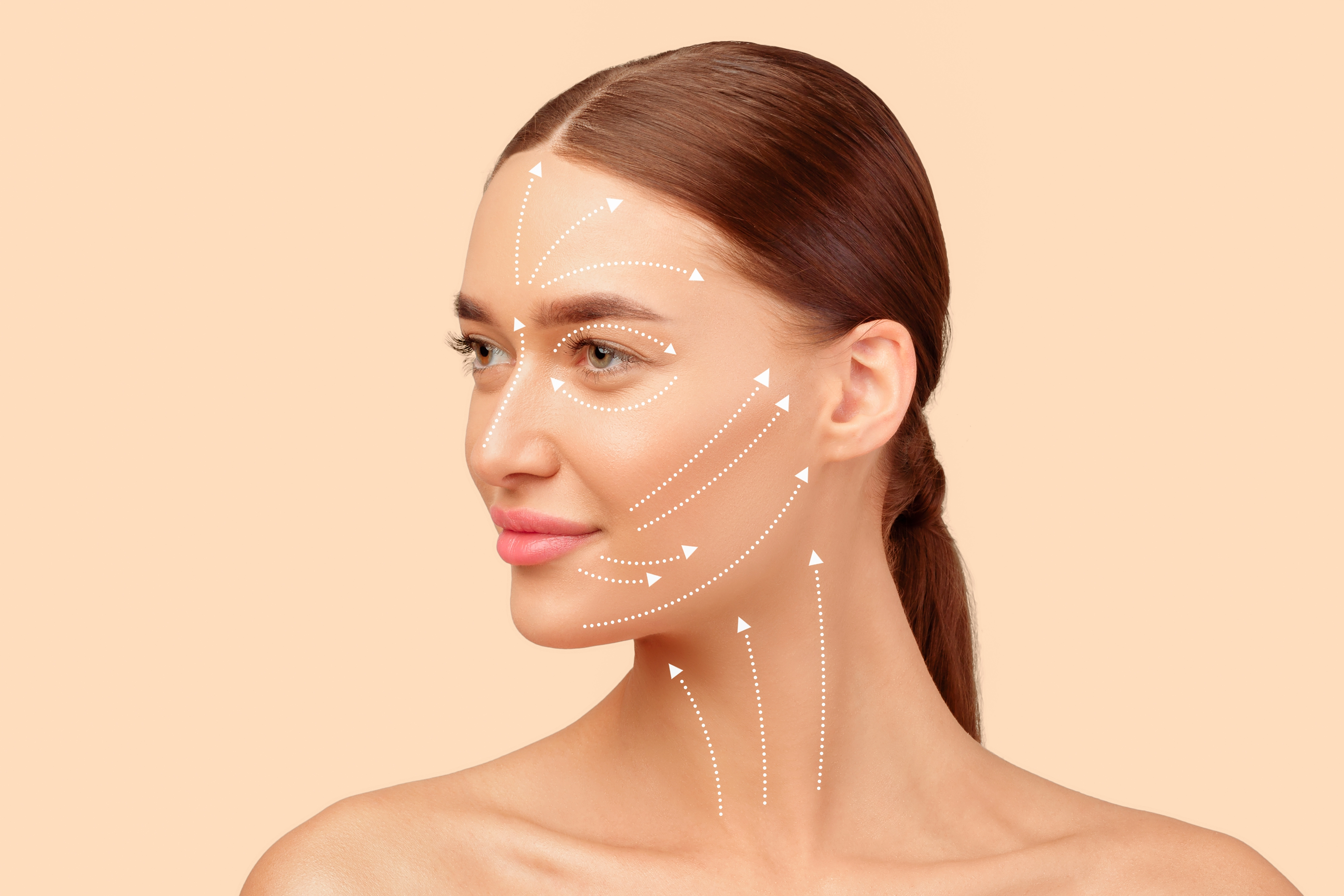 A woman's face and neck shown in profile with dotted arrows illustrating skin-lifting and tightening directions for a facelif