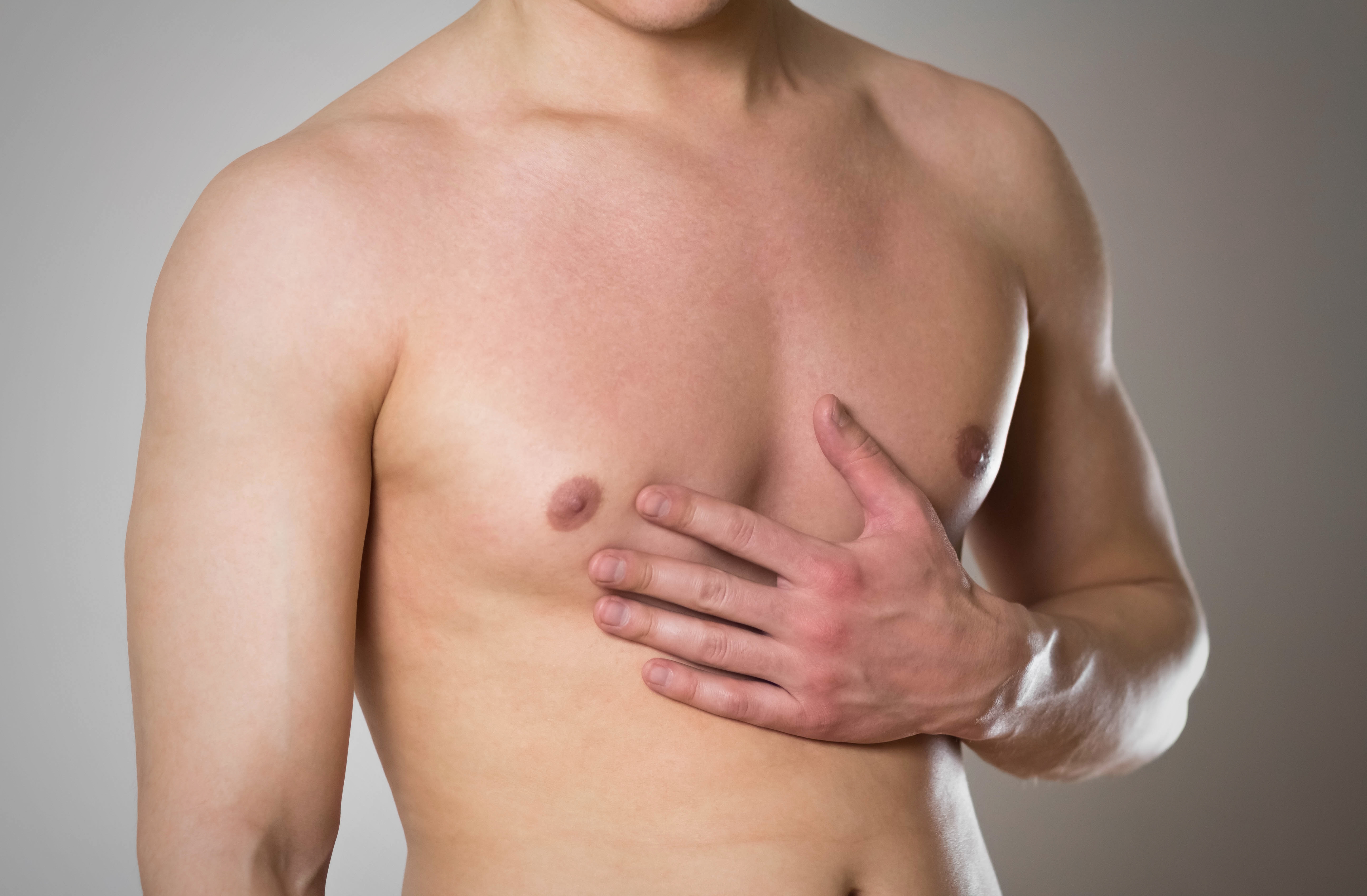 Shirtless man resting a hand on his chest, showing fullness from enlarged male breast tissue