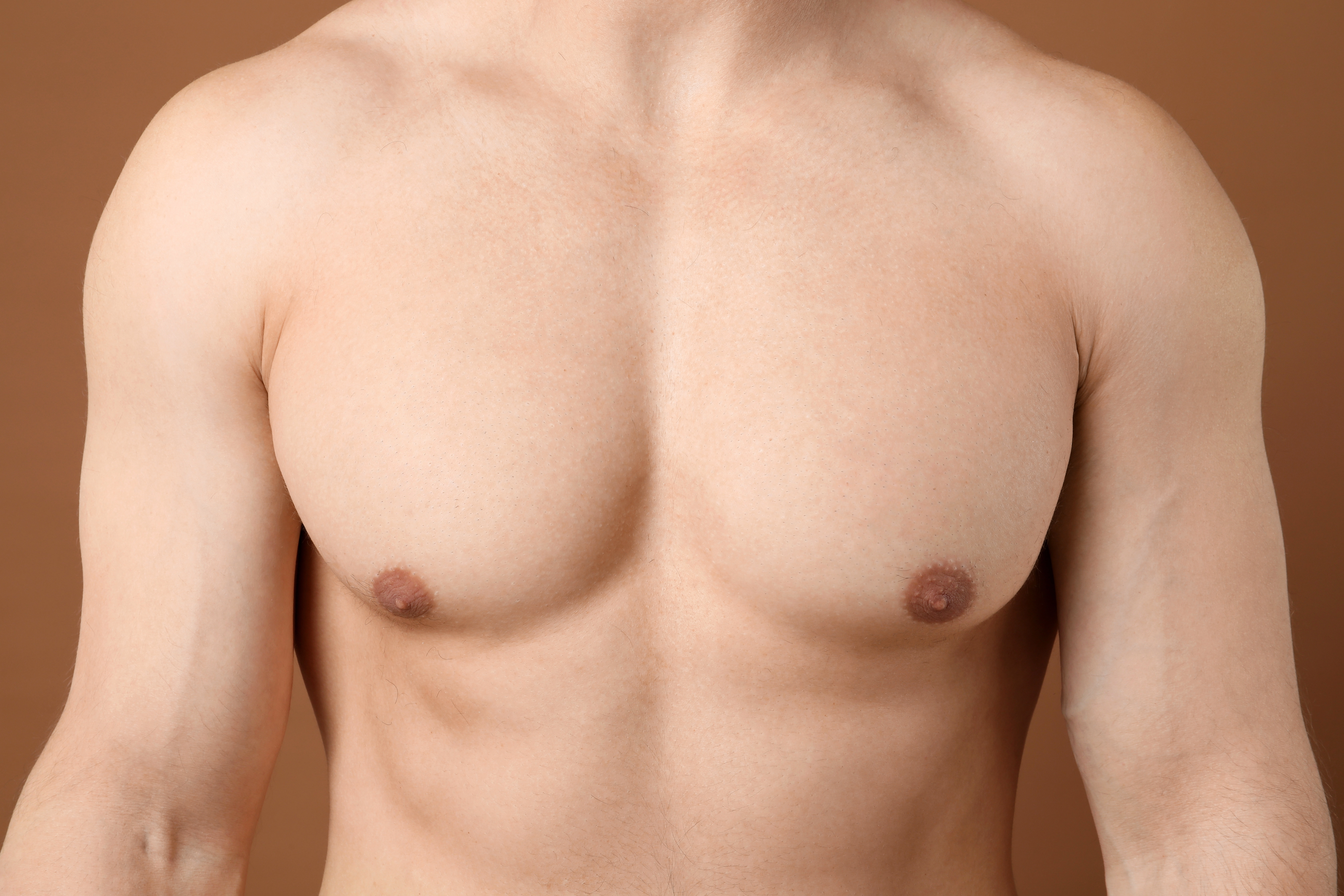Close-up studio photo of a shirtless man's bare chest showing enlarged male breast tissue, illustrating gynecomastia