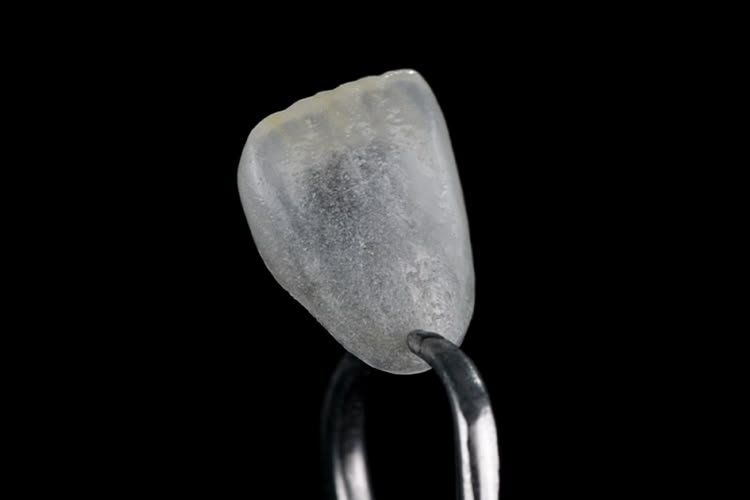 Close-up studio photo of a feldspathic porcelain veneer held by tweezers against a black background