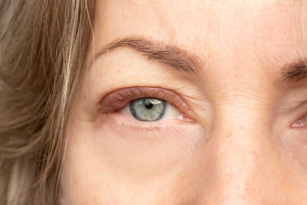 Extreme close-up of a woman's eye and eyelid showing skin texture and eyelid hooding
