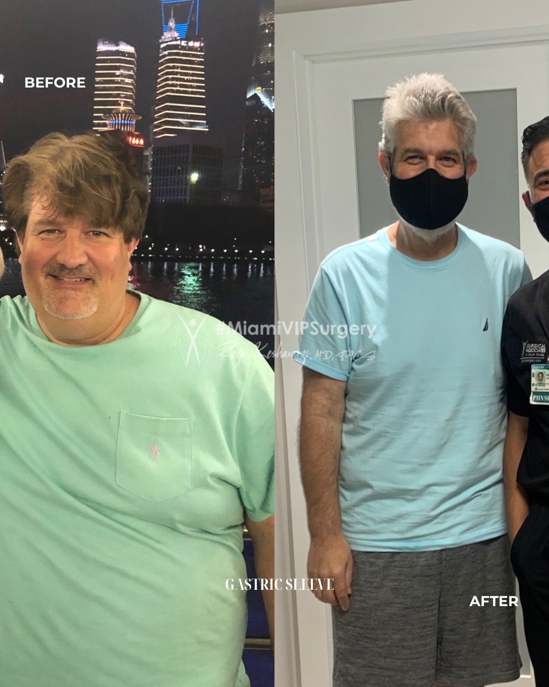 Before and after gastric sleeve, man in a green shirt before and noticeably slimmer after