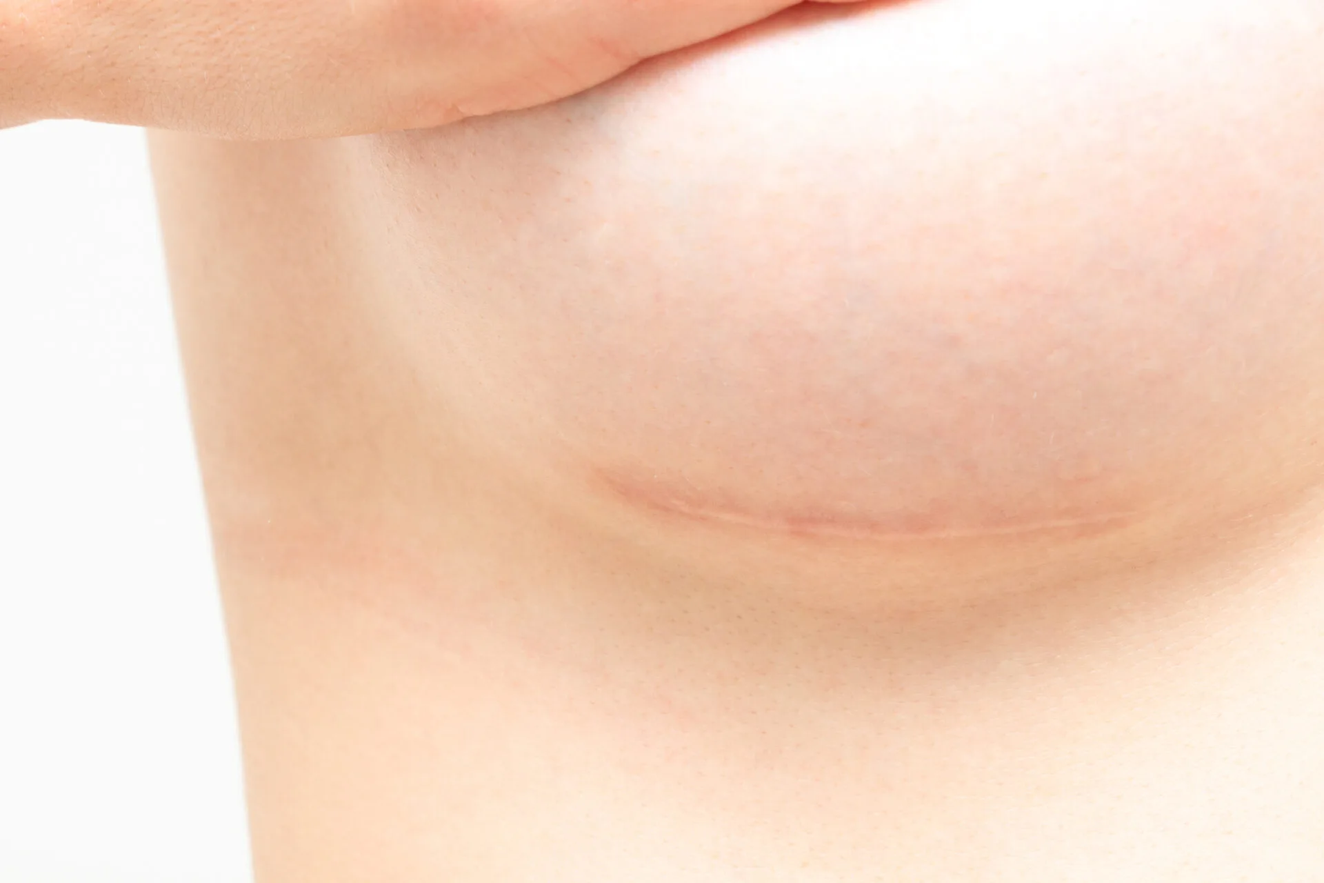 plastic surgeon consultation with a patient about breast reduction