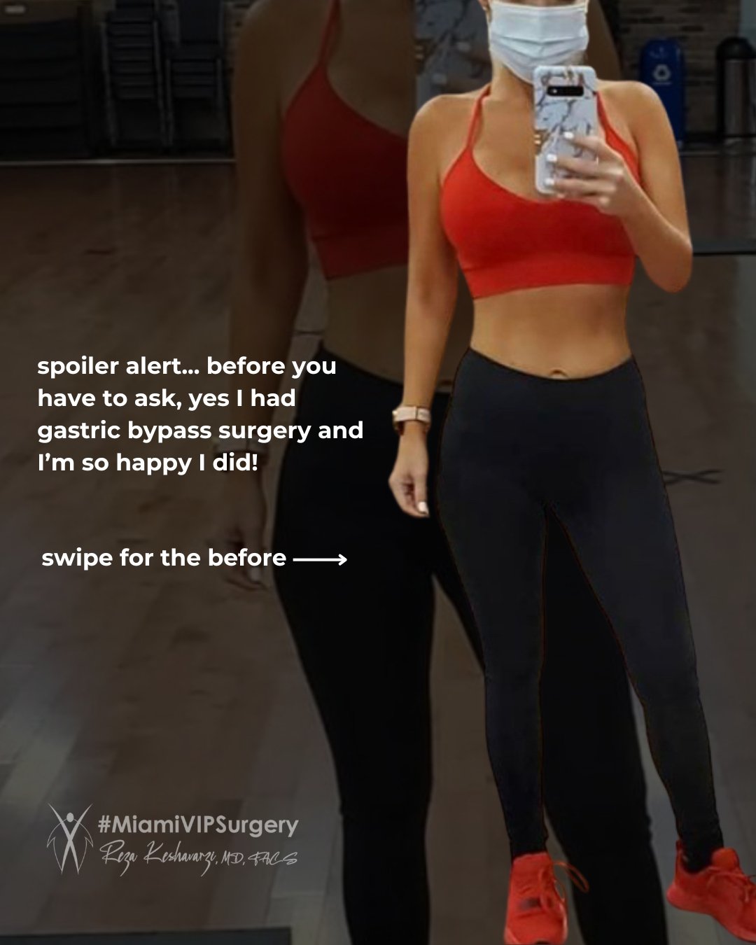Gastric bypass patient of Dr. K in a gym mirror selfie after her weight loss, with her own note saying she had gastric bypass and is happy she did
