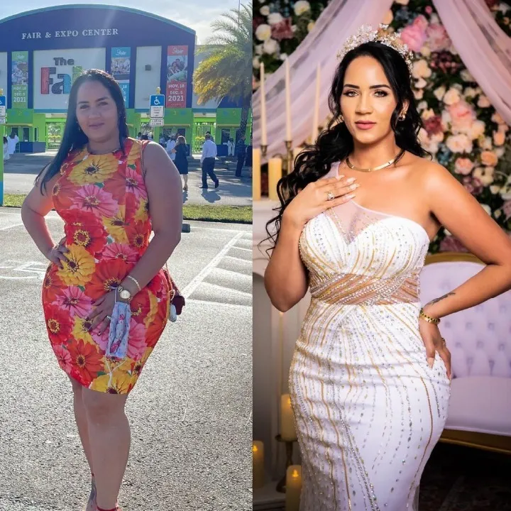 Before and after weight loss surgery: a woman in a floral dress, then slimmer in a white gown