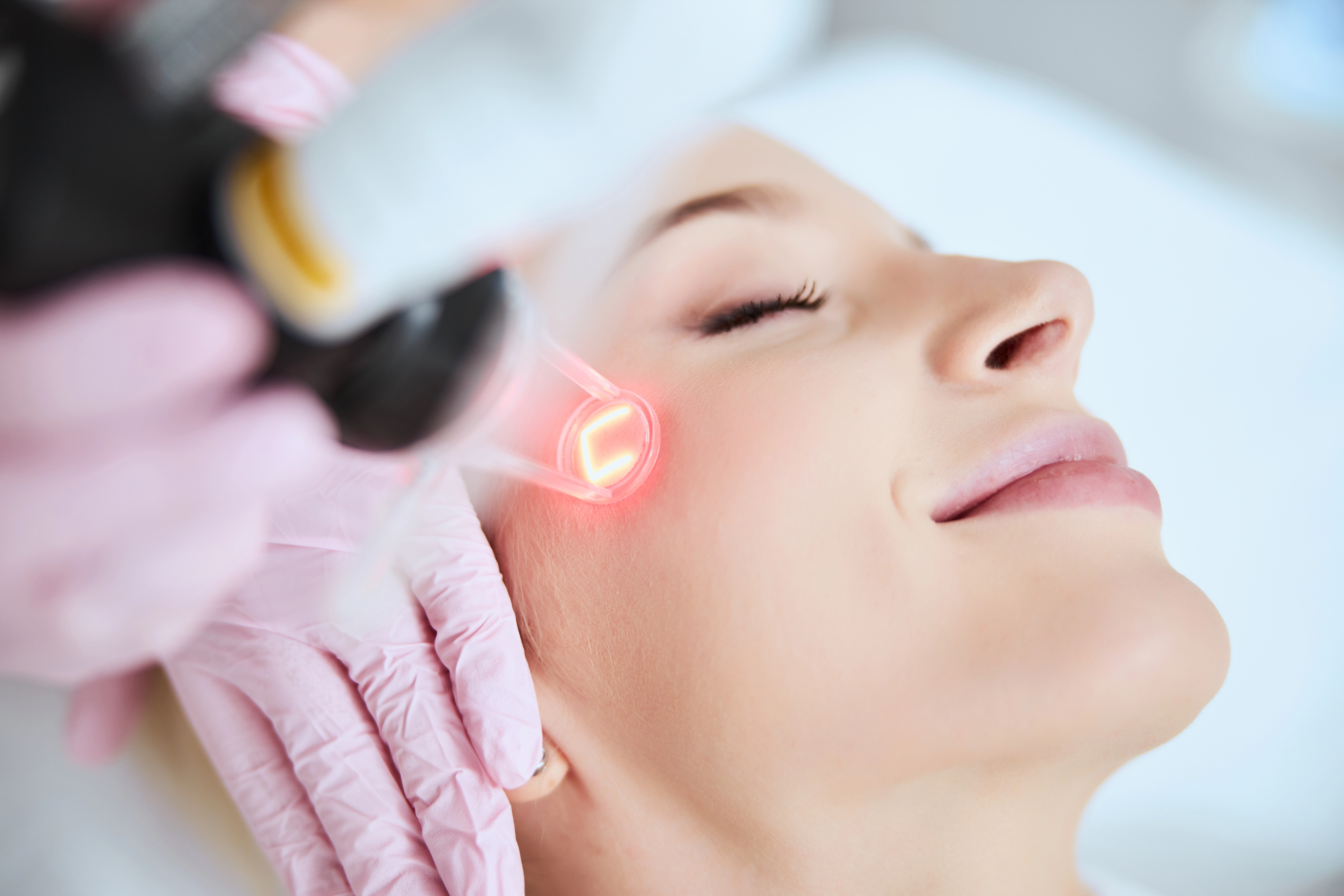 A woman receives a laser skin resurfacing treatment on her cheek from a gloved provider