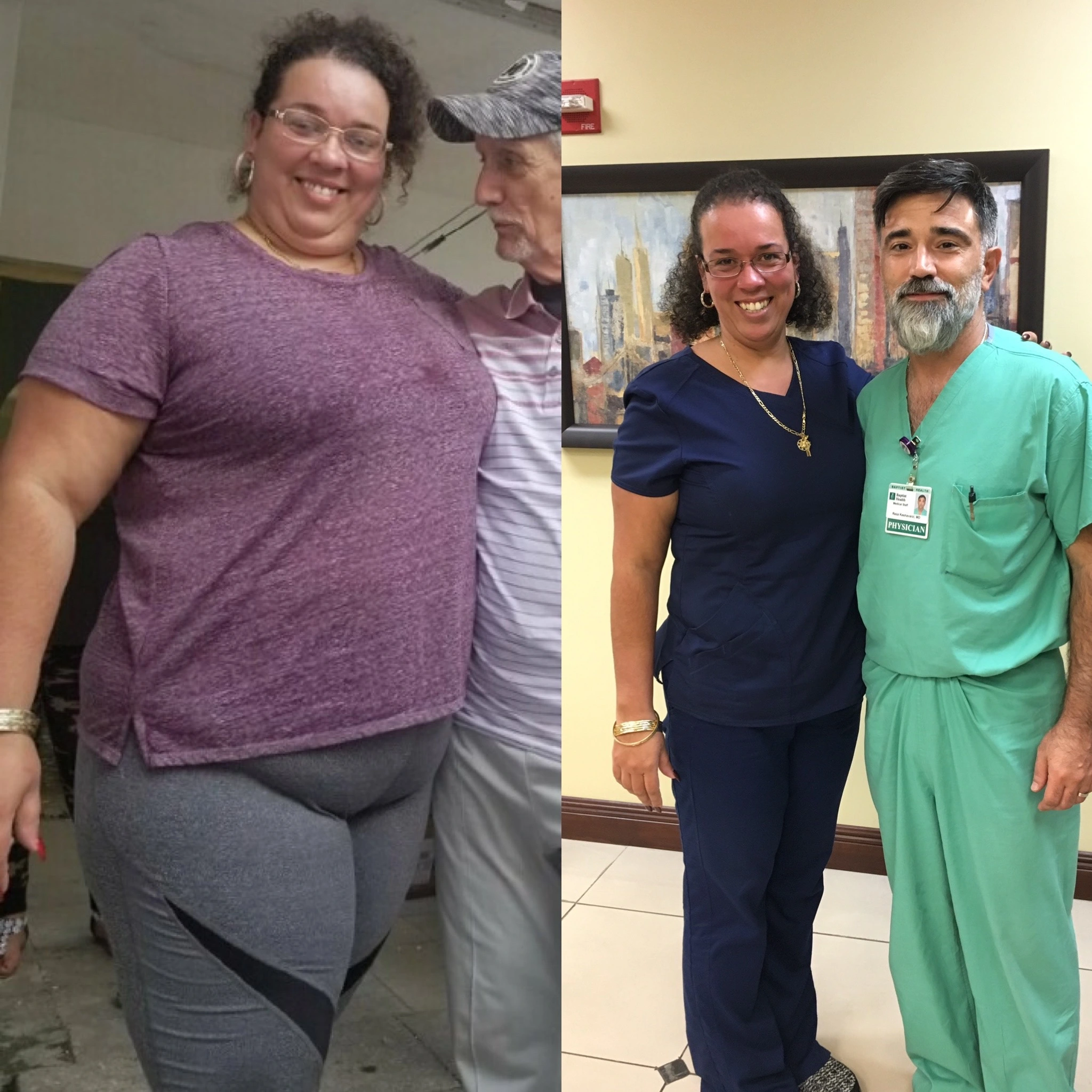 Before and after bariatric surgery: a woman in a purple top, then slimmer standing beside her surgeon in scrubs