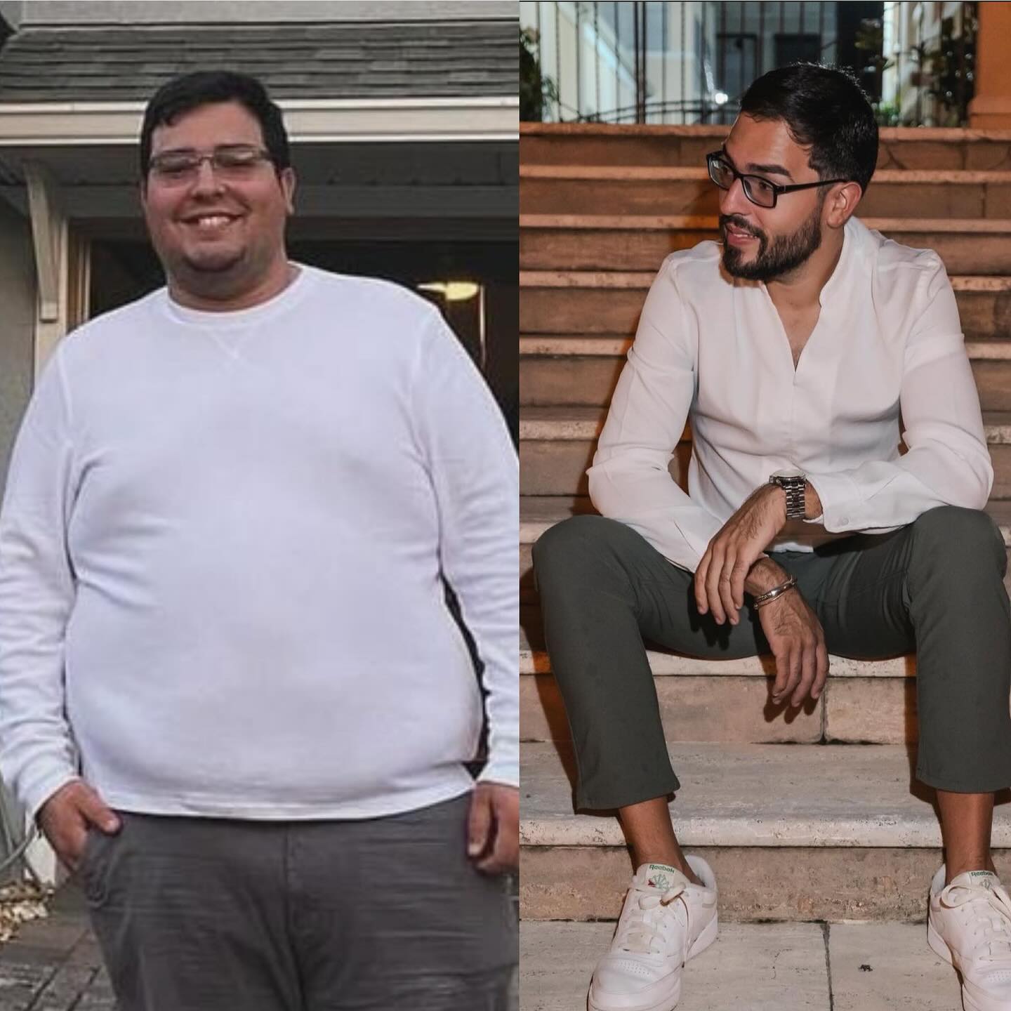 Young man in a white sweatshirt before bariatric surgery and slimmer in a white shirt after
