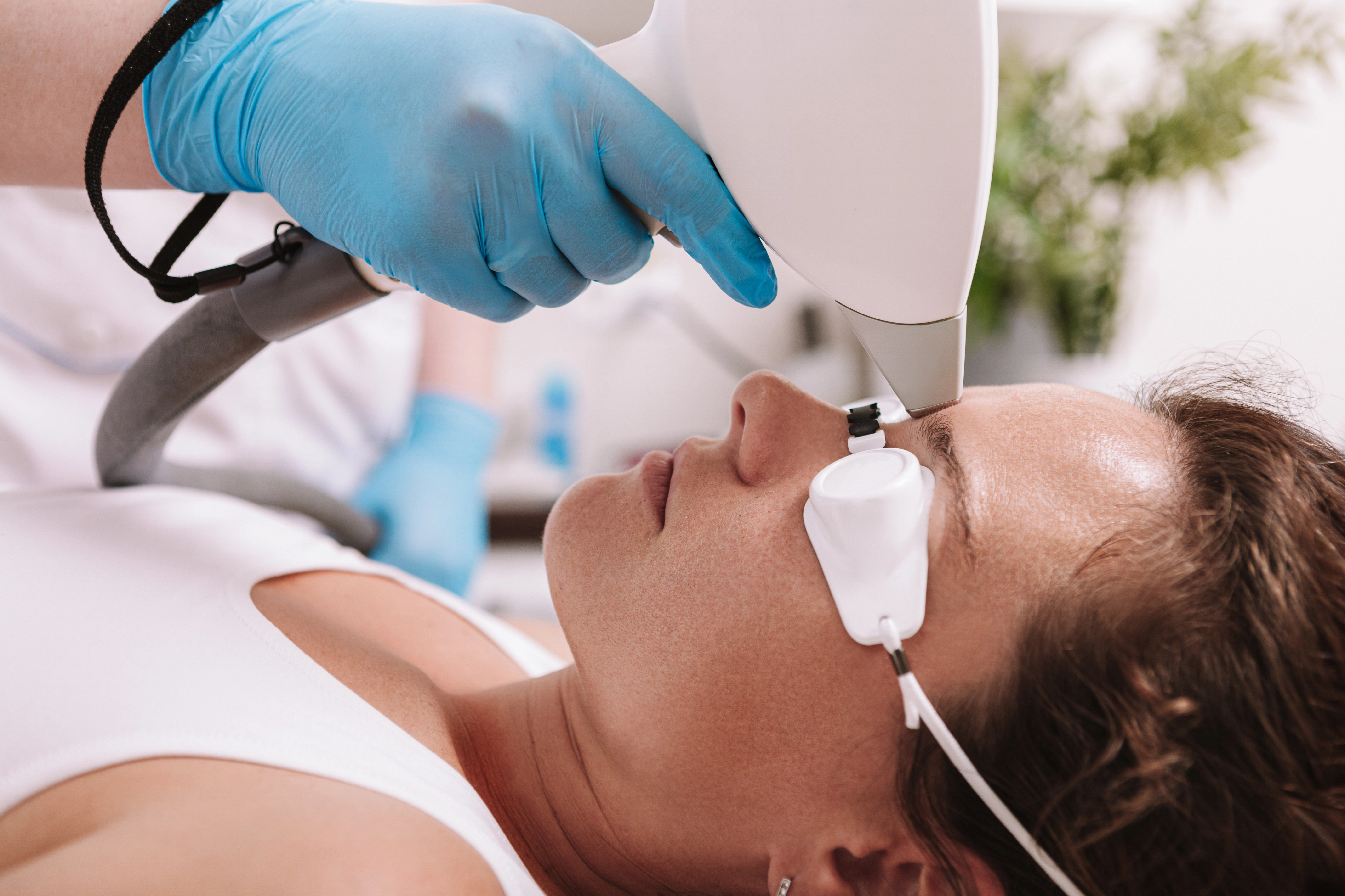A gloved provider performs a laser hair removal treatment on a woman's face while she wears protective eyewear