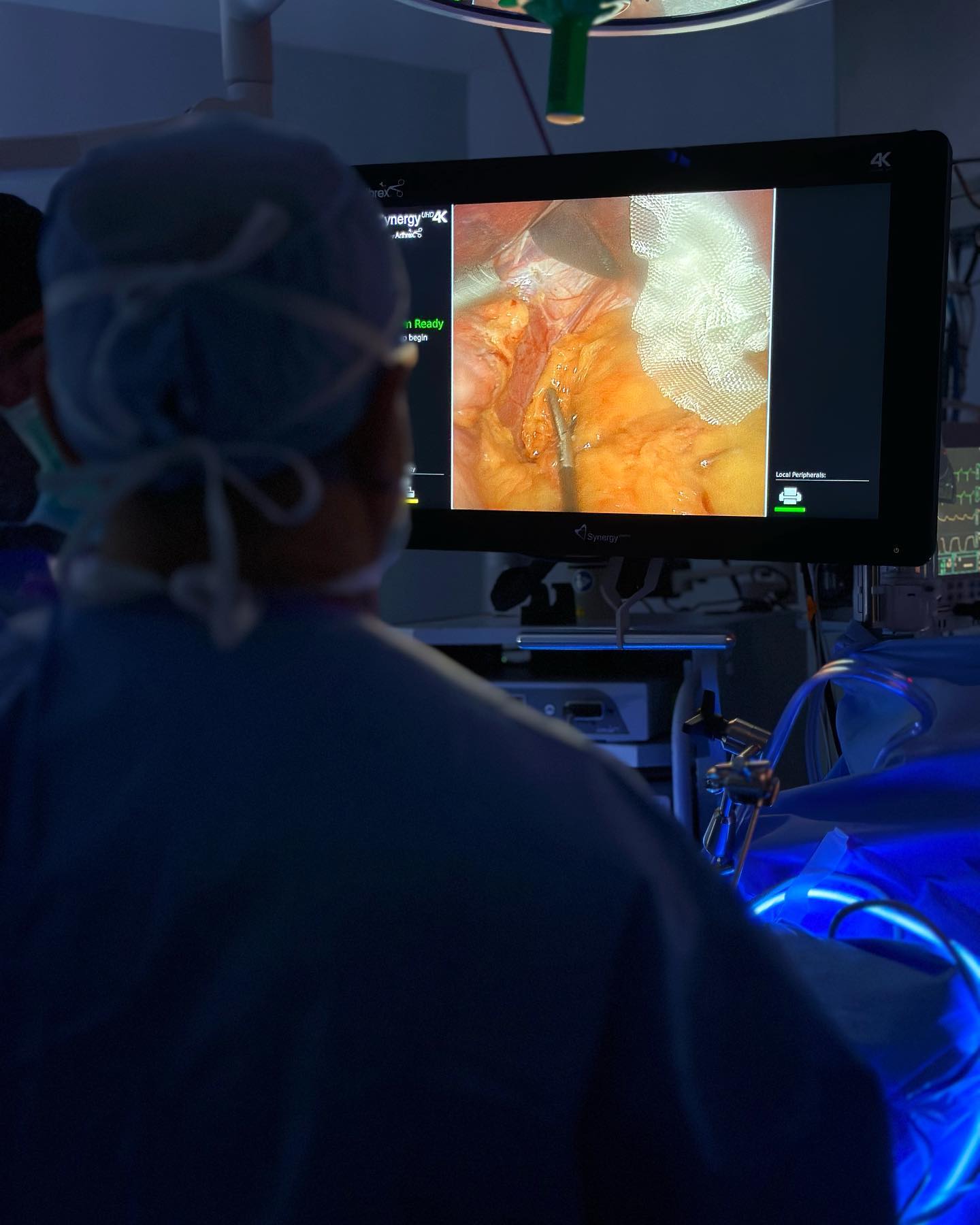 Dr. Keshavarzi in the operating room watching the laparoscopic camera feed during a gastric sleeve surgery